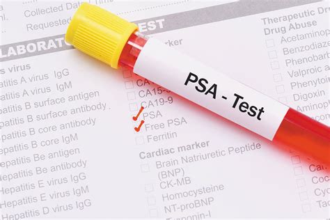 psa blood test bottle uk|advice before psa blood test.